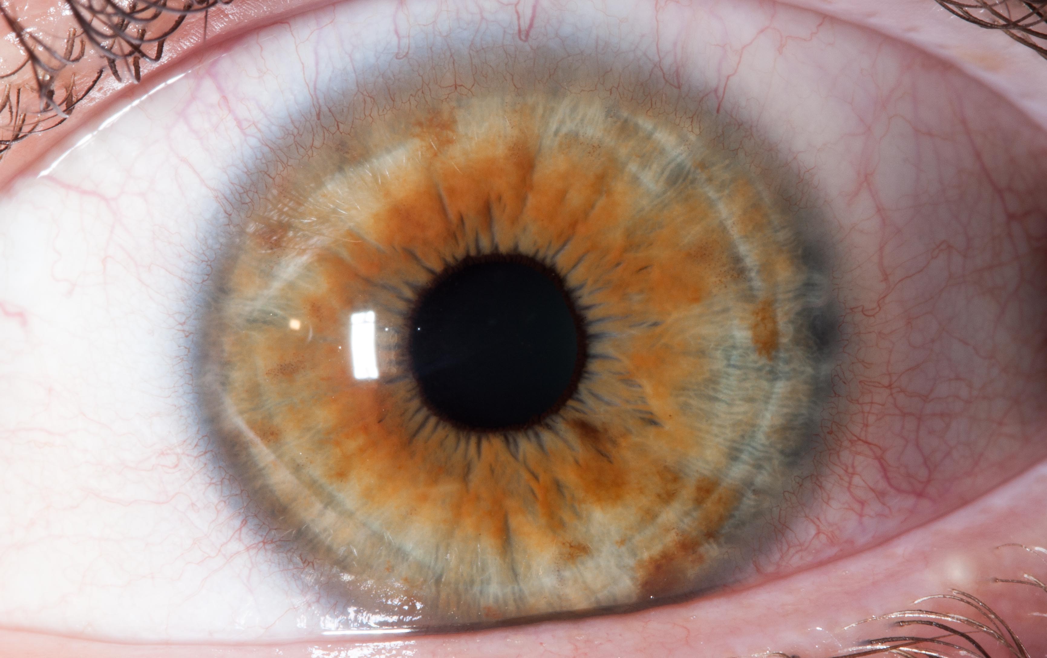 Wie Sehen Die Augen Eines Sterbenden Aus www.hpbrasch.de